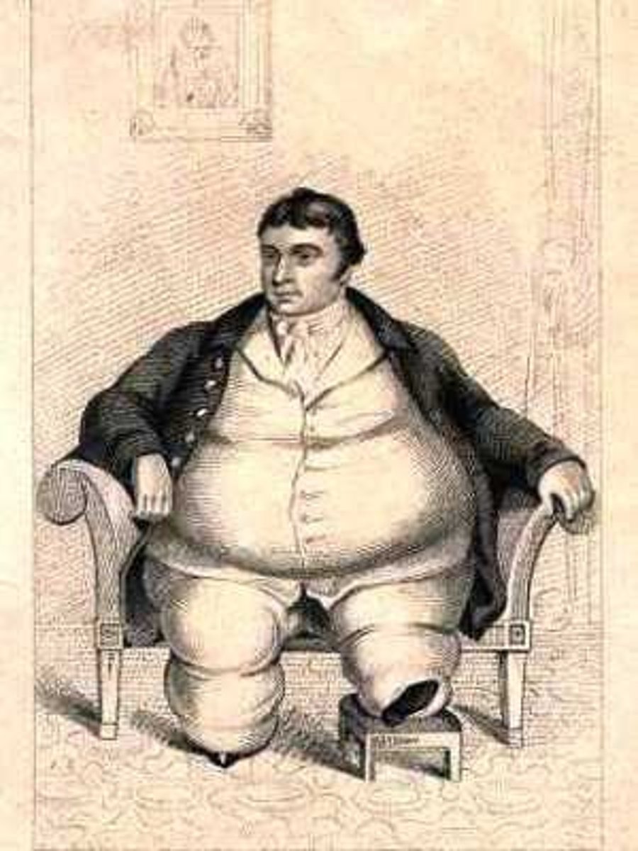 <p>corpulence (obesity)</p>