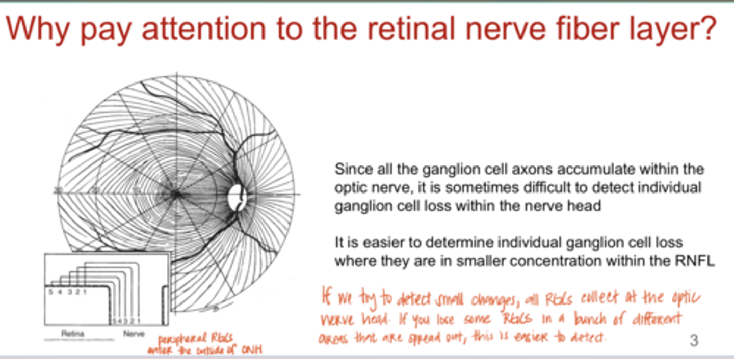 <p>When is it easier to determine individual ganglion cell loss?</p>