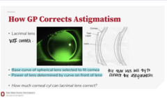 <p>How do GP lenses correct astigmatism?</p>