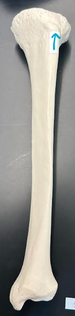 <p>ID tibia region </p>
