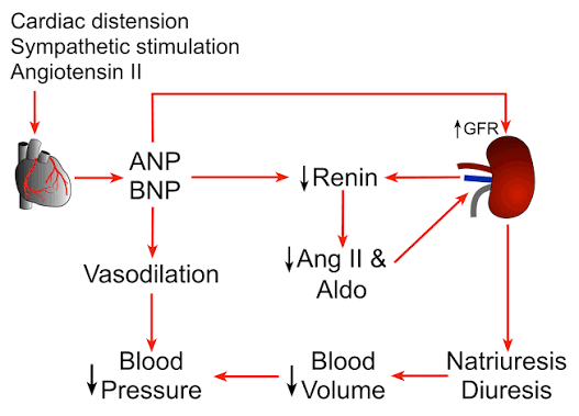 <p><strong>Answer:</strong><br><strong>E) Obesity-hypoventilation syndrome</strong>, likely with coexisting obstructive sleep apnea.</p><p><strong>Why:</strong><br>Severe obesity causes nocturnal hypoventilation and upper-airway obstruction → hypoxemia and pulmonary hypertension → right-heart strain, explaining the <strong>P pulmonale and leg edema</strong>. Obesity-hypoventilation syndrome is associated with daytime hypoxemia/hypercapnia, sleepiness, pulmonary hypertension, and cor pulmonale.</p><p>During obstructive episodes, strong inspiratory effort creates very negative intrathoracic pressure, which stretches the atria and increases <strong>atrial natriuretic peptide (ANP)</strong>:</p><p><strong>↑ ANP → sodium and water excretion → nocturia.</strong></p><p></p><p><strong>Flashcard rule:</strong><br><strong>Severe obesity + daytime sleepiness + hypoxemia + P pulmonale/edema + nocturia → obesity-hypoventilation/OSA. Nocturia results from increased ANP.</strong></p>