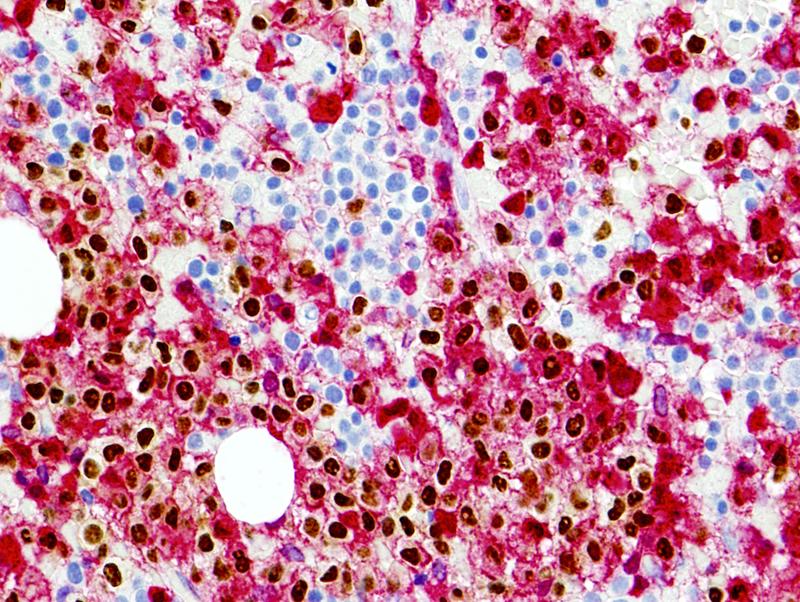 <p>Identifica el tejido y las células presentes</p>