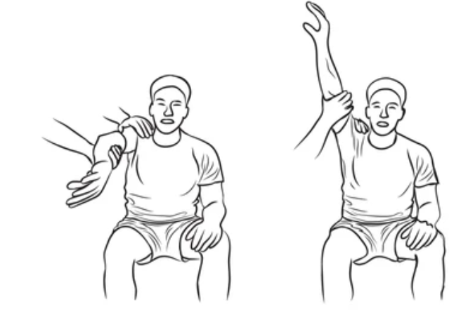 <p>Keep the arm straight and slowly lift it all the way up over the head. Pain during this movement is positive.</p><p>impingment syndrome</p>