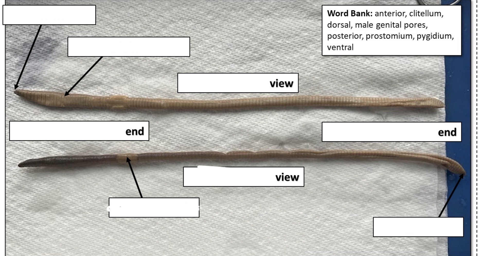 <p>Anterior</p>