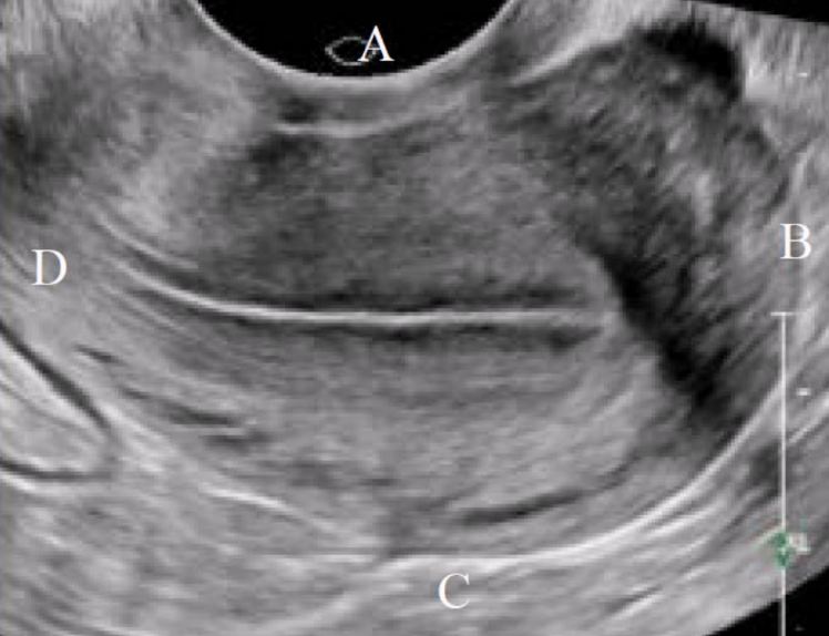 <p><span style="background-color: transparent;">What is letter B in this image?&nbsp;</span></p><p><span style="background-color: transparent;">a. Posterior&nbsp;</span></p><p><span style="background-color: transparent;">b. Left&nbsp;</span></p><p><span style="background-color: transparent;">c. Inferior&nbsp;</span></p><p><span style="background-color: transparent;">d. Superior</span></p>