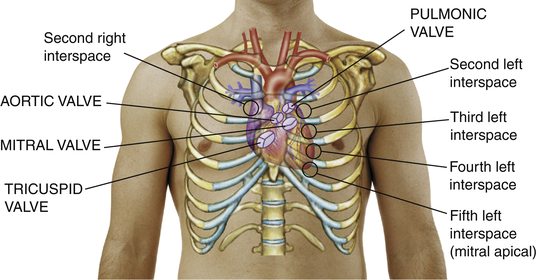 <p>3rd intercostal space, left sternal margin</p><p>Me <strong>Tri </strong>al</p>