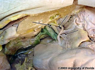<p>what vein is being indicated to in the image?</p>