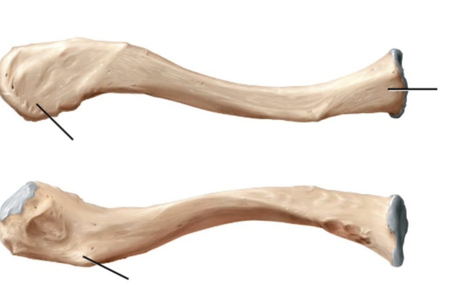 <p>Clavicle: Term A, B, C. Word bank: Sternal end, Acromial end, Conoid tubercle.</p>