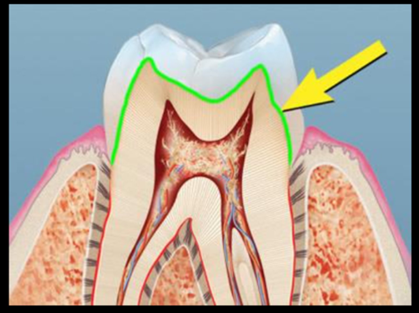 <p>the inner surface of enamel where enamel joins dentin</p>
