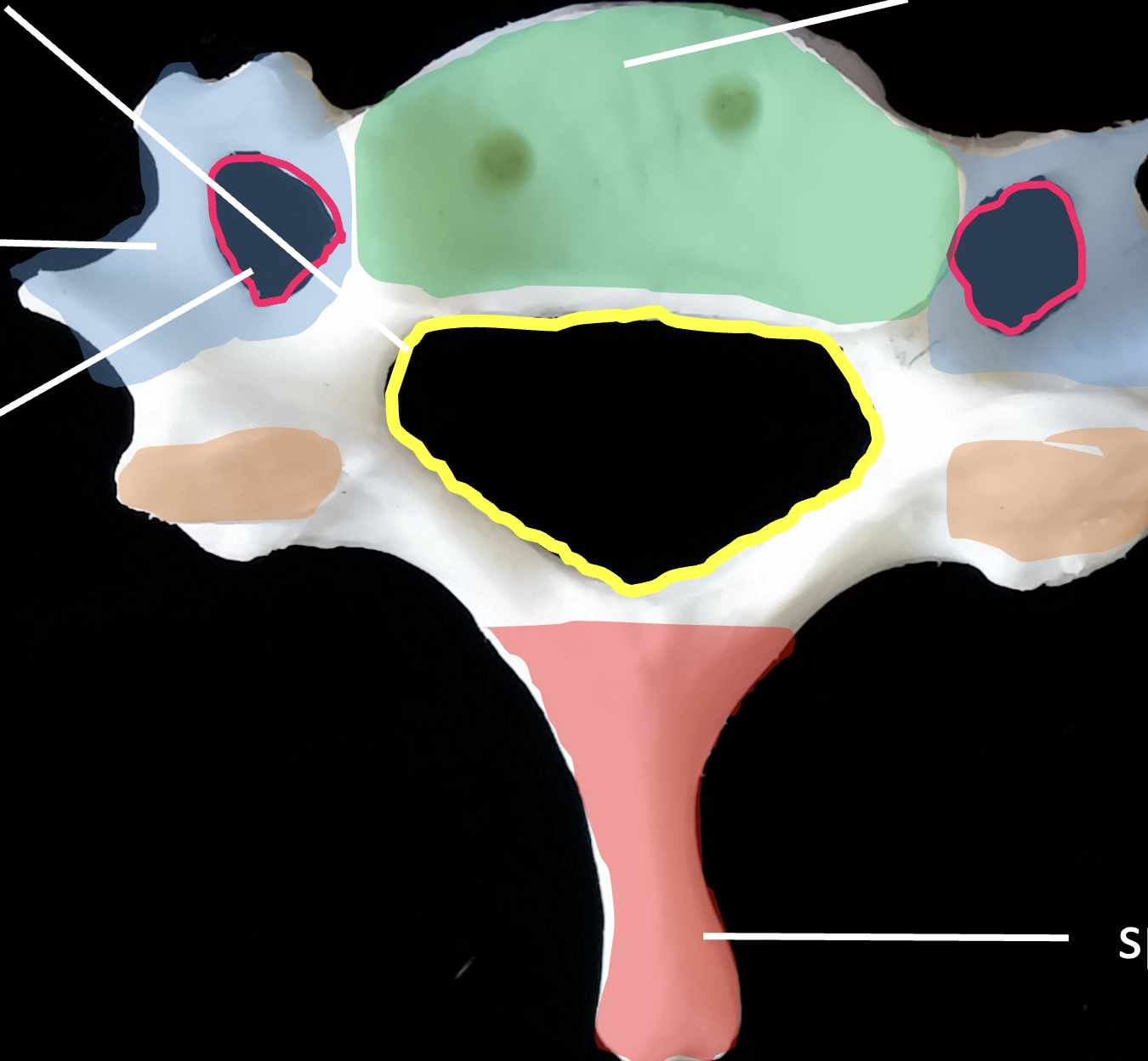 <p>What is the orange region highlighted on the C3-C7 cervical vertebrae?</p>