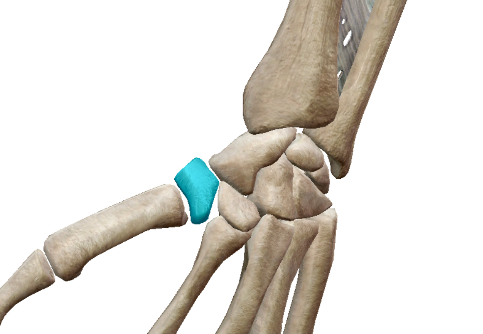 term image