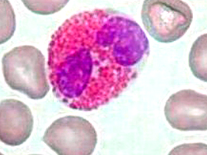 <p>Parasitaire infecties en allergische reacties</p>