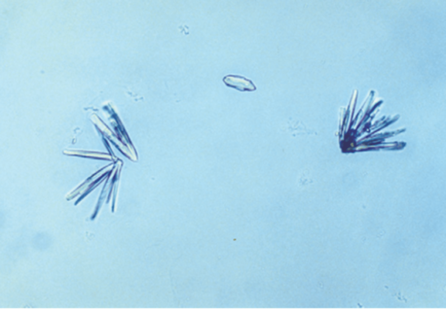 <p>pH >7.5</p>