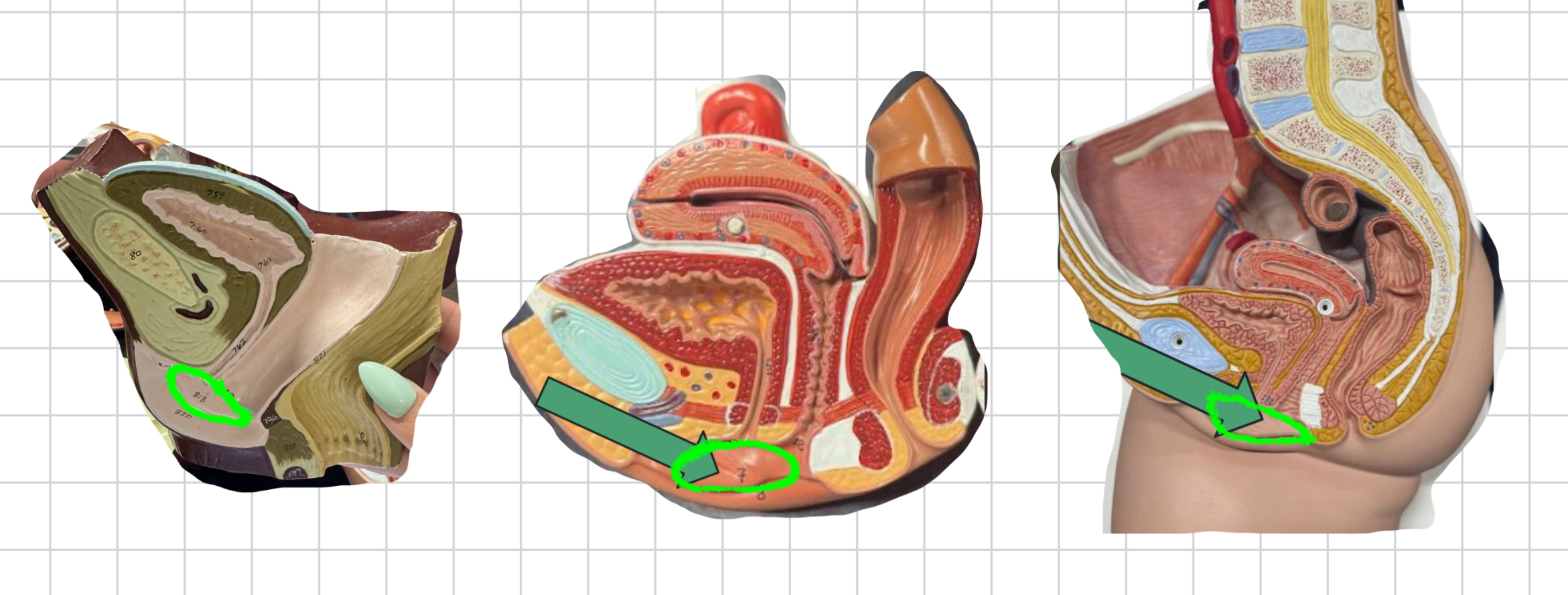 term image