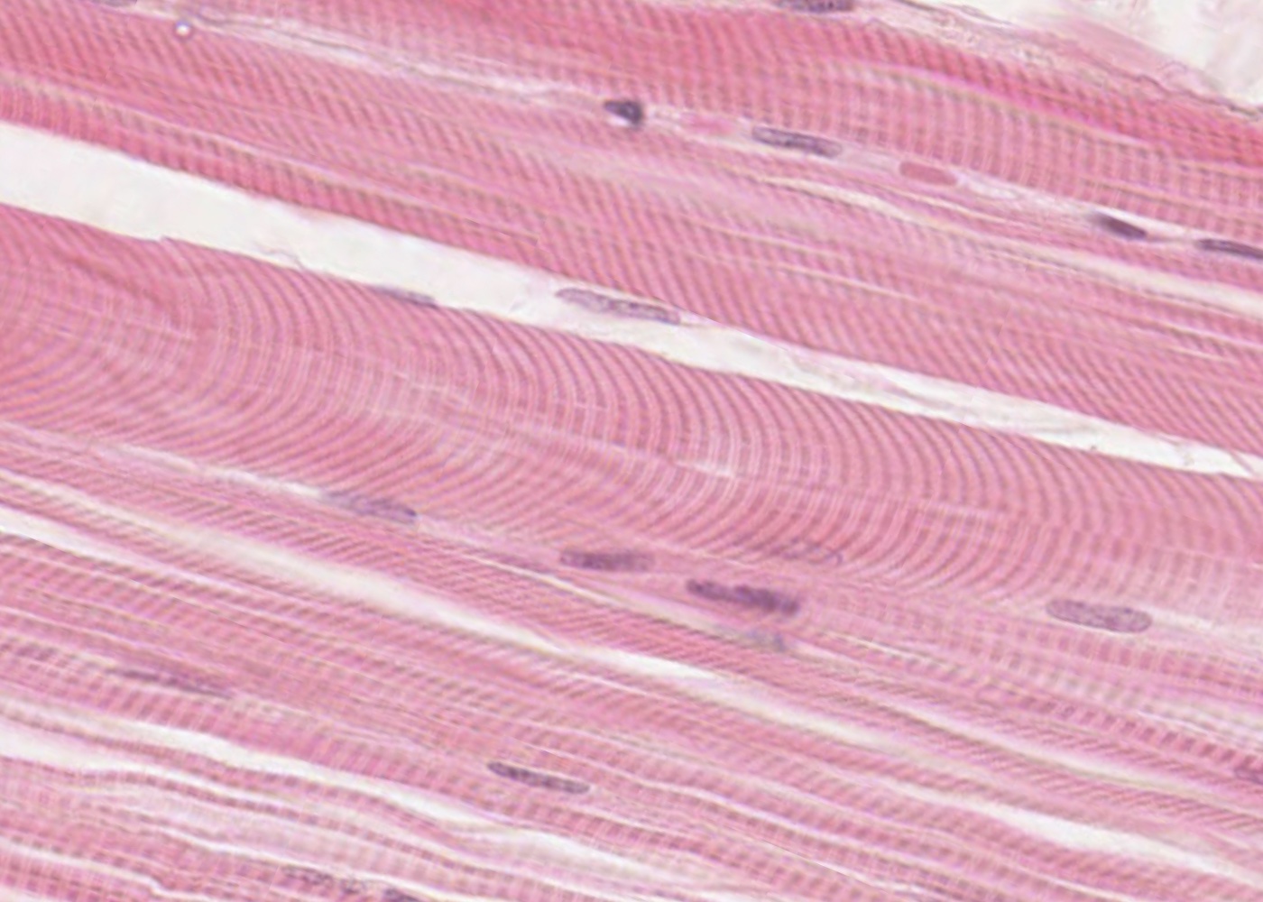 <p>Skeletal Muscle Tissue </p>
