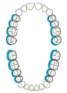 <ul><li><p>Posterior aspects facing away from clinician in blue</p></li><li><p><strong>Clock position</strong>: 2 o’clock </p></li></ul><p></p>