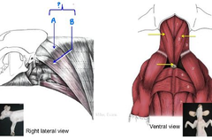 <p>What muscle is this?</p>
