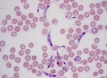 <p>PATHOGENIC PROTISTS:</p>