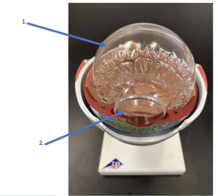 <p><span>What is the name of the fluid that fills the posterior chamber of the eye as indicated by #1?</span></p>