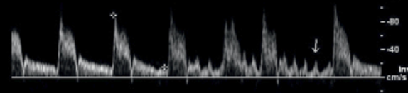 <p>Based on the waveforms, which vessel do these belong to?</p>