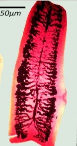 <p>taenia saginatta </p>