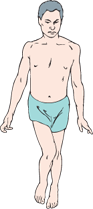<p>What is this gait pattern called?</p>
