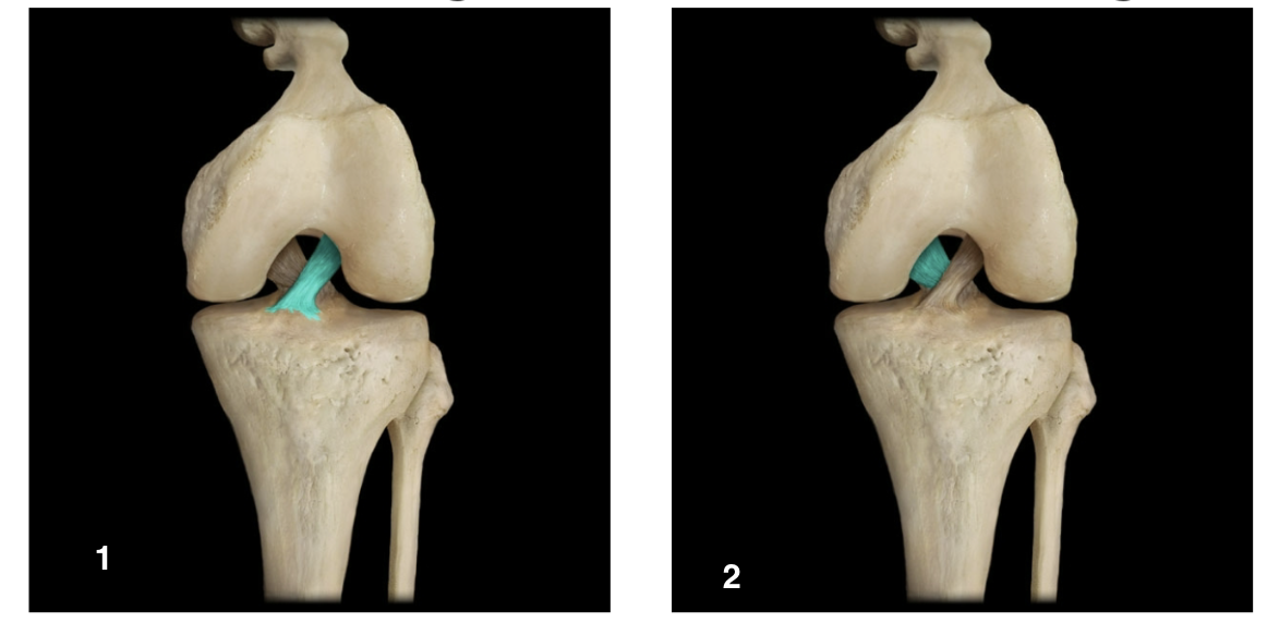 <p>What ligament is highlighted in image 2?</p>