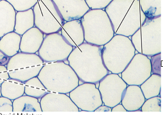 <p>Are these parenchyma or collenchyma cells?</p>