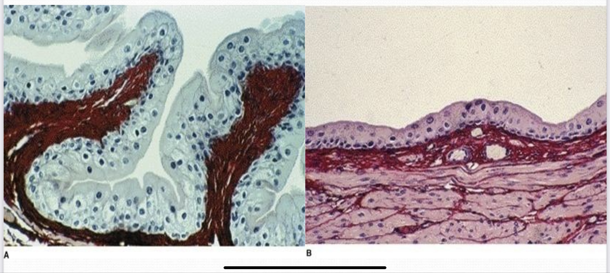 <p>Keratinized stratified squamous epithelium</p>