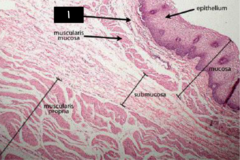 <p>What is labeled 1?</p>