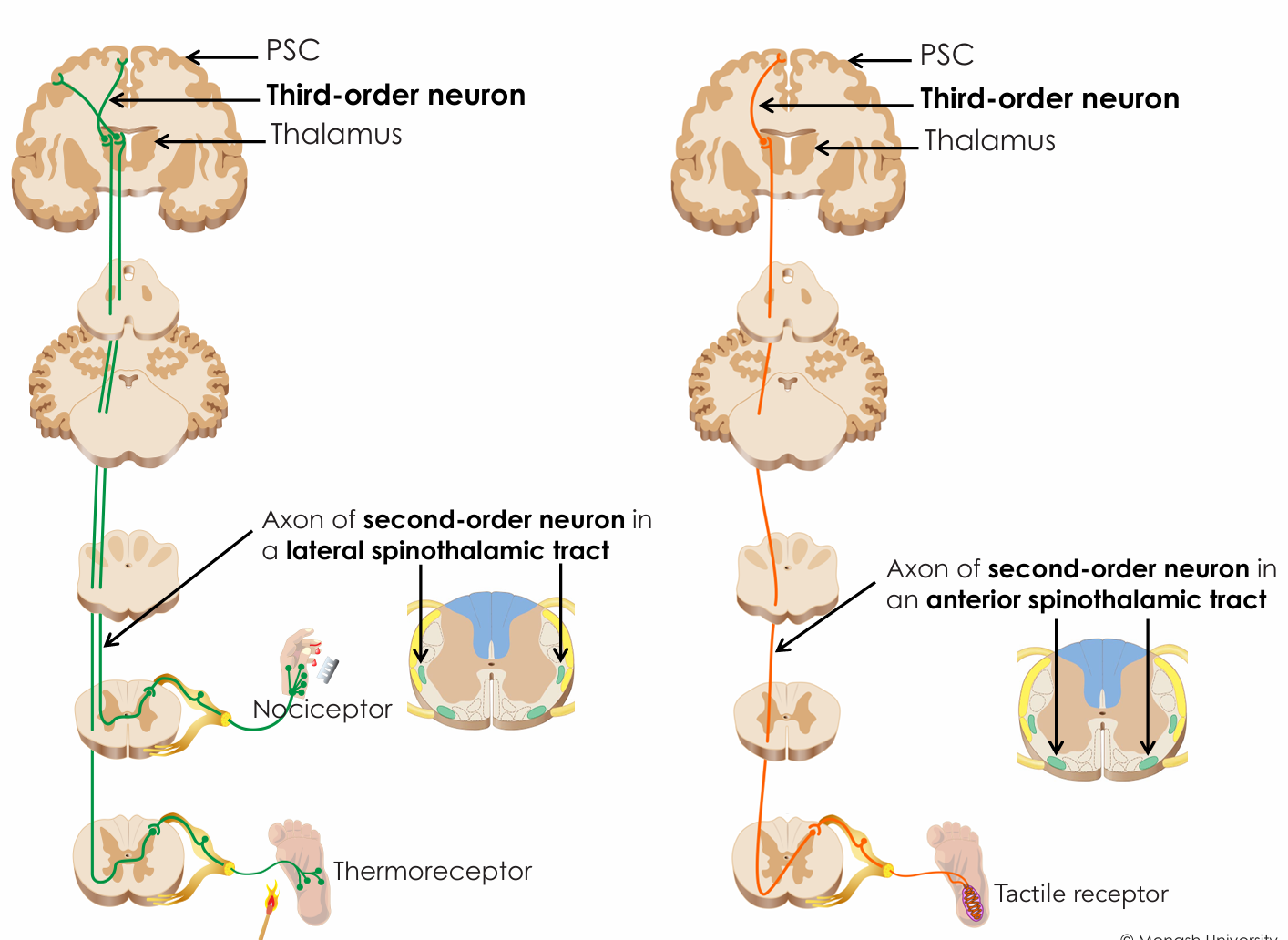 <ul><li><p>In the thalamus</p></li></ul><p></p>