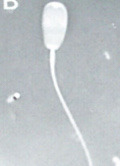 <p>What is this? Normal or abnormal sperm?</p>