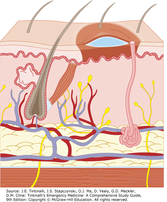 <ul><li><p>Epidermis and superficial dermis (papillary layer) injured</p></li><li><p>Deeper layers of dermis, hair follicles, and sweat/sebaceous glands spared </p></li><li><p>Often caused by hot water or scalding </p></li><li><p>Skin is <strong>blistered</strong> and exposed dermis is red and moist → painful to tough </p></li><li><p>Healing occurs in 14-21 days with minimal scarring </p></li><li><p>Have full return of skin function </p></li></ul><p></p>