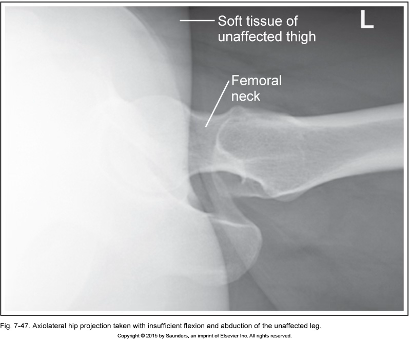 <p>hip axiolateral (danelius-miller/x-table)</p>