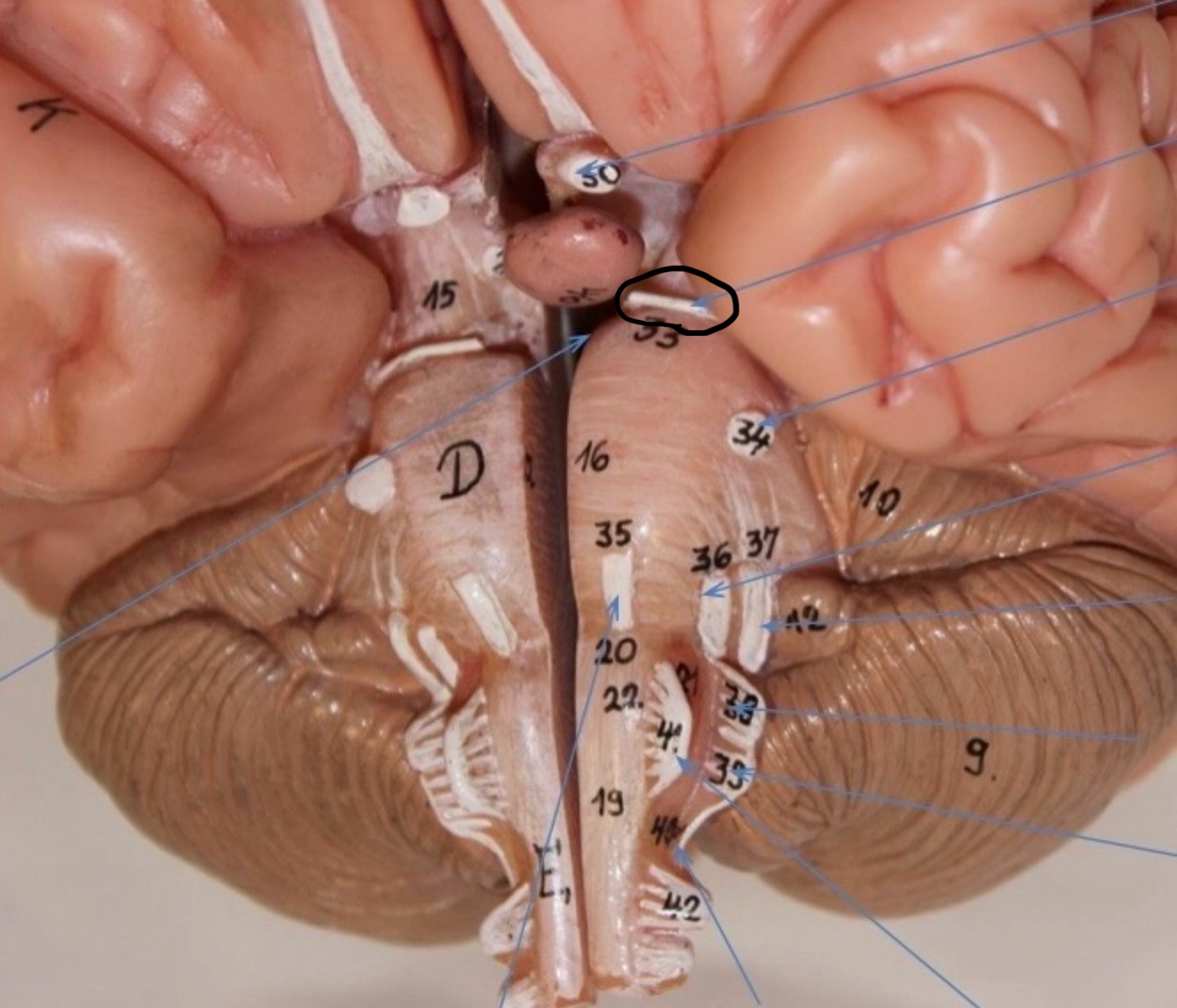 <p>Identify the circled area?</p>