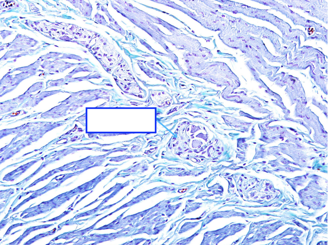 <p>Cấu trúc gì ?</p>