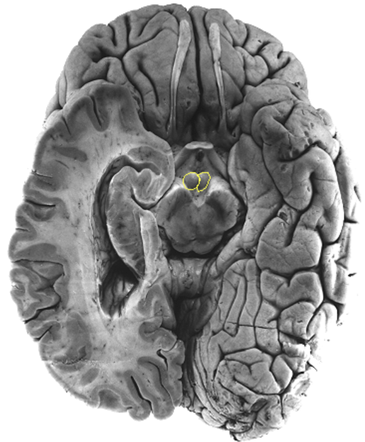 <p>What is the area highlighted called?</p>