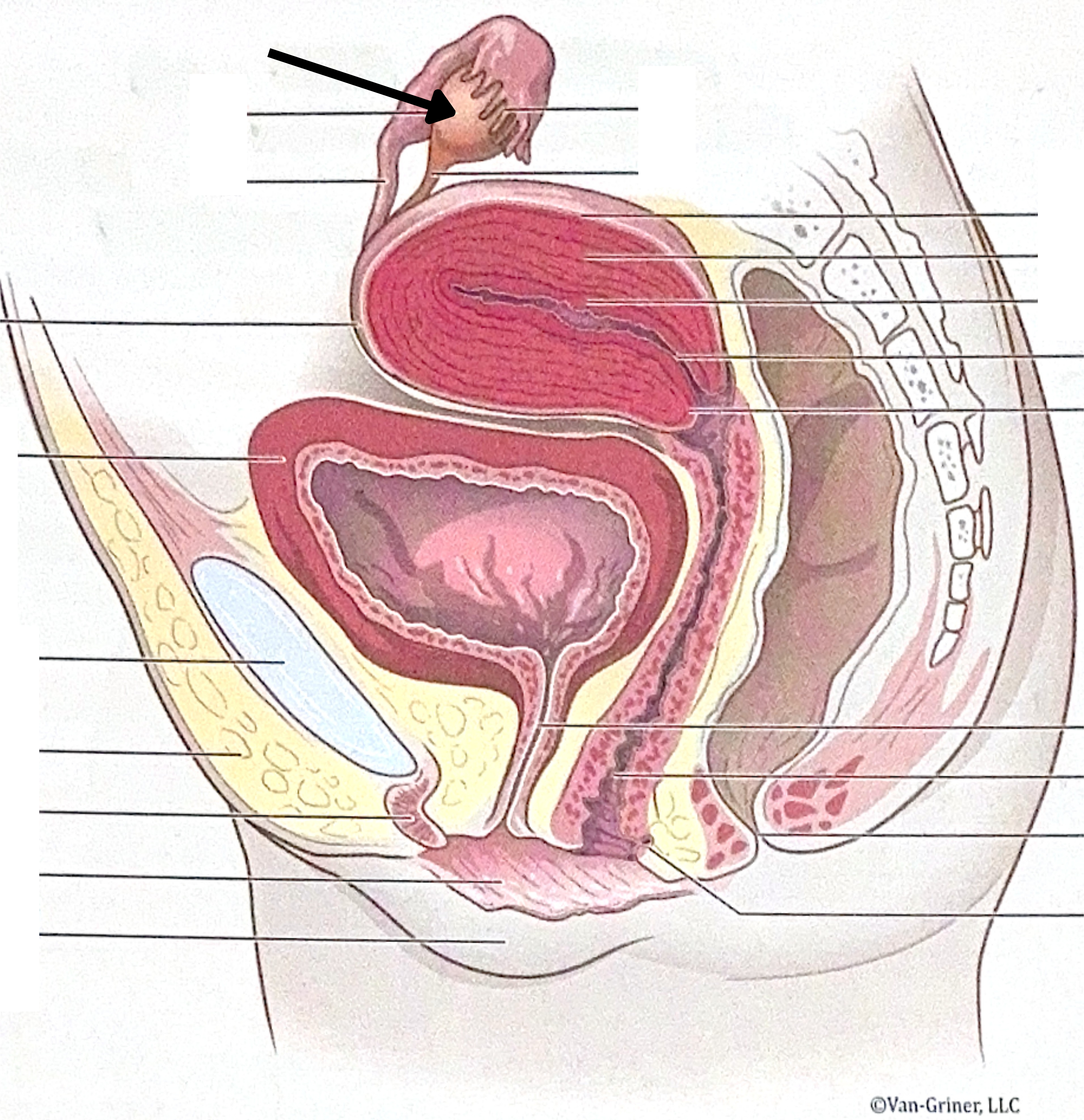 <p>What is the structure indicated in the image?</p>