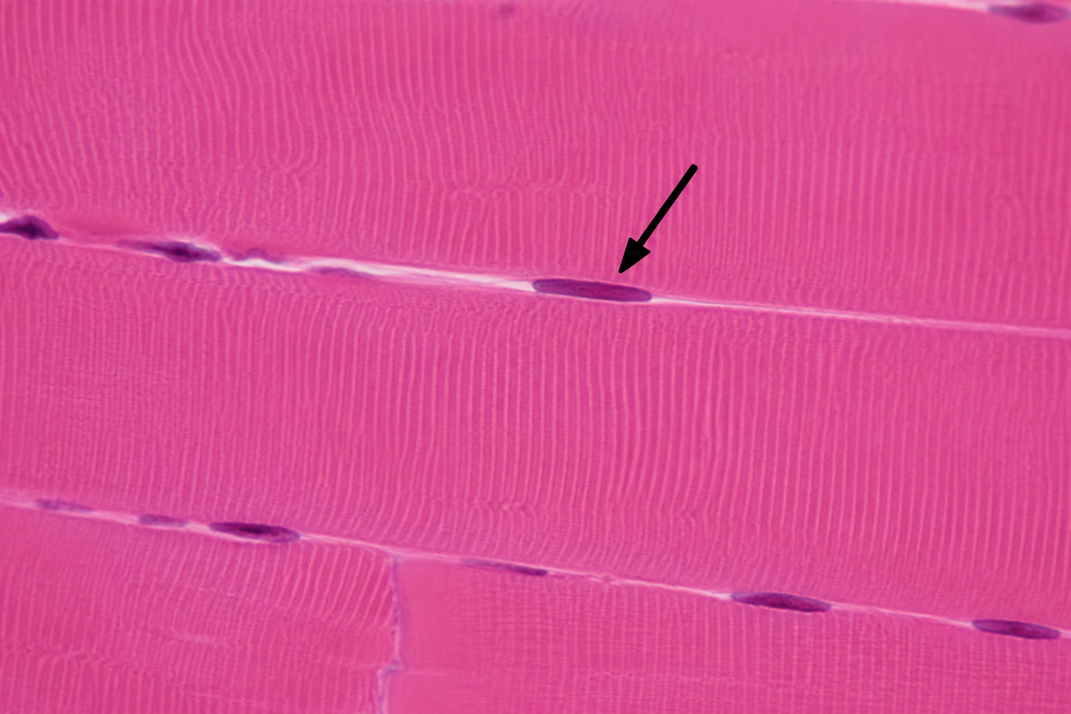 <p>Nucleus of muscle cell (fiber)</p><p>Also called myonucleus </p>