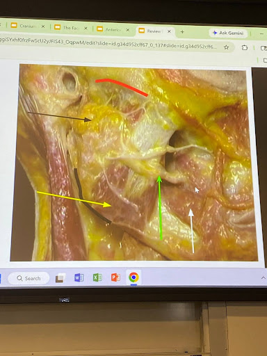 <p>black:</p><p>Yellow:</p><p>Nerves comes through:</p><p>Green arrow:</p><p>White arrow:</p><p>Yellow:</p><p>Artery on top of masseter:</p><p>Red:</p><p>A little in front of that muscle =</p><p></p>