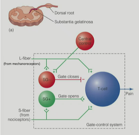 <p>the “gate” contains <strong><u>substantia gelatinosa cells</u></strong> <u>in the </u><strong><u>dorsal horn </u></strong><u>of the SC </u>(<strong><u>SG- and SG+</u></strong> are inhibitory or excitatory neurons in dorsal horn of the SC that regulate pain)</p><p>__</p><p>input going into the gate comes from:</p><ul><li><p><strong><u>large diameter (L) fibers</u></strong> - information from <u>tactile stimuli via mechanoreceptors</u></p></li><li><p><strong><u>small diameter (S) fibers</u></strong> - information from <u>nociceptors</u></p></li><li><p><strong><u>central control</u></strong> - information from <u>cognitive factors from the cortex</u></p></li></ul><p>__</p><p>pain doesn’t occur / pain is blocked when:</p><ul><li><p><strong><u>central control</u></strong><u> → activate SG- cell (inhibitory) → gate closes → inhibits T-cell to block pain</u></p><ul><li><p>(top-down process)</p></li></ul></li><li><p><strong><u>L-fibers from mechanoreceptors</u></strong><u> → activate SG- cell (inhibitory) → gate closes → inhibits T-cell to block pain</u></p><ul><li><p>(bottom-up process)</p></li></ul></li></ul><p>_</p><p>pain does occur when:</p><ul><li><p><strong><u>S-fibers from nociceptors</u></strong> → activate <strong><u>SG+</u></strong> cell (excitatory) → gate <strong><u>opens </u></strong>→ <strong><u>activates </u></strong>T-cell to <u>induce pain</u></p></li></ul><p></p>