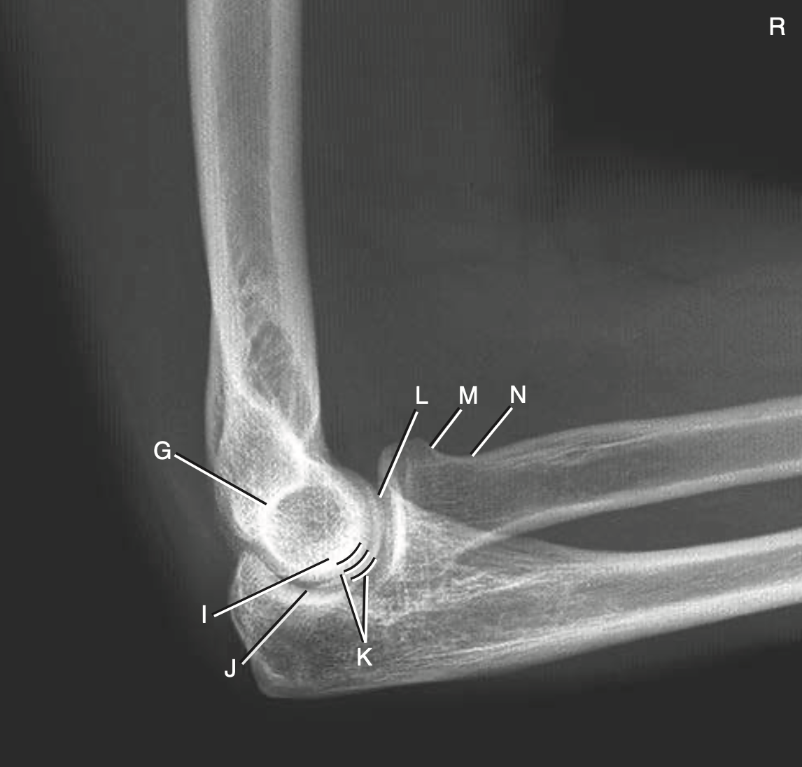 <p>I</p>