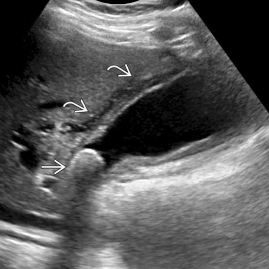 <p>Name findings and diagnosis</p>