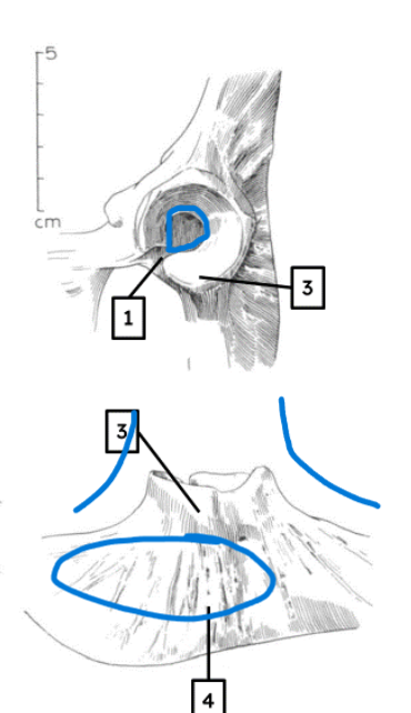 <ul><li><p>tall, sharp rim</p></li><li><p>pronounced ridges </p></li><li><p>narrow acetabular notch</p></li></ul><p></p><p>pig pelvis </p><p></p>