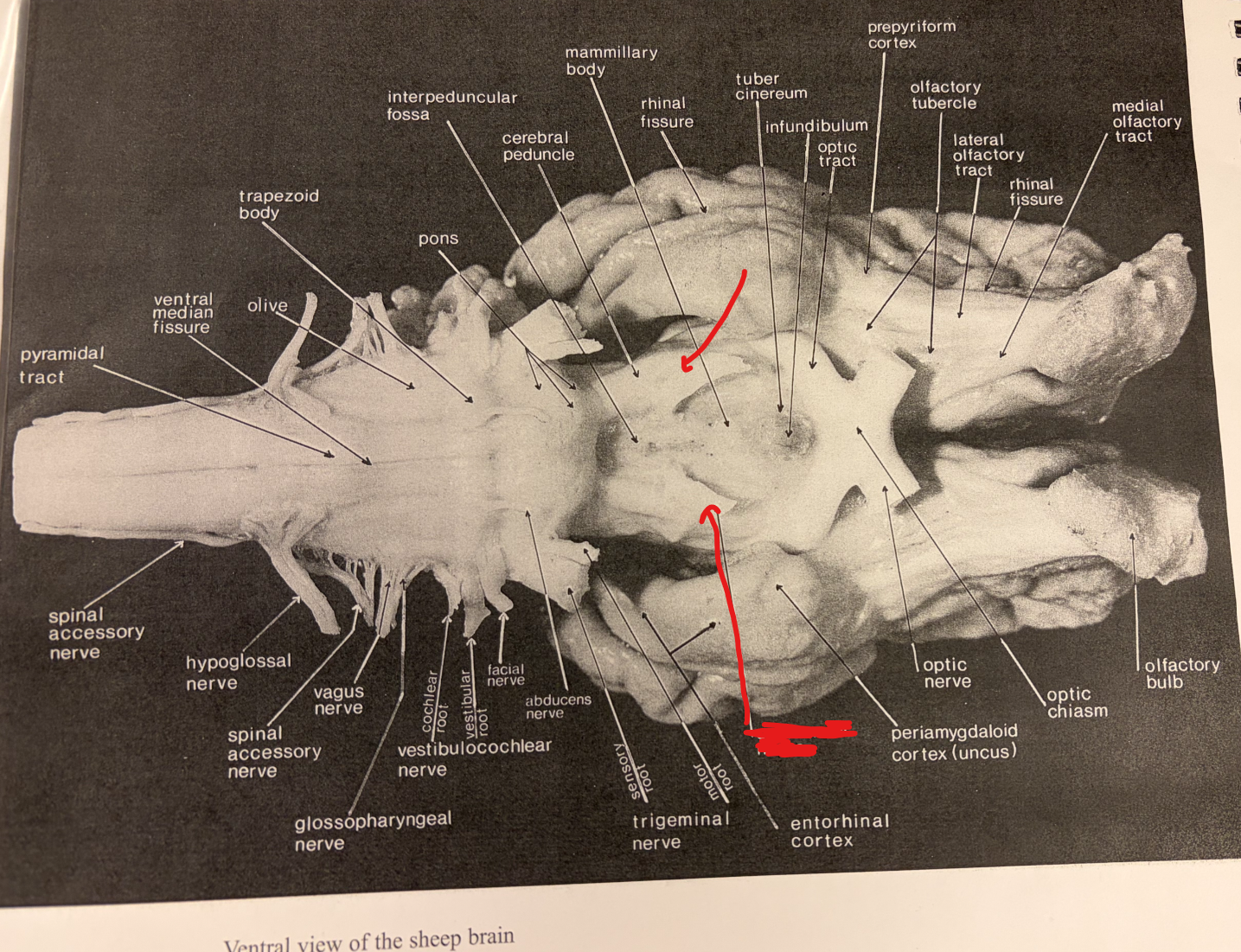 <p>Ventral Surface: Structure?</p>