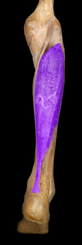 <p>ankle plantarflexion</p>