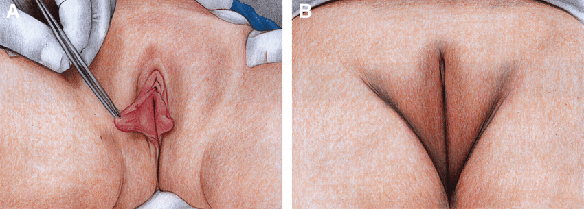 <p>labia minora </p>