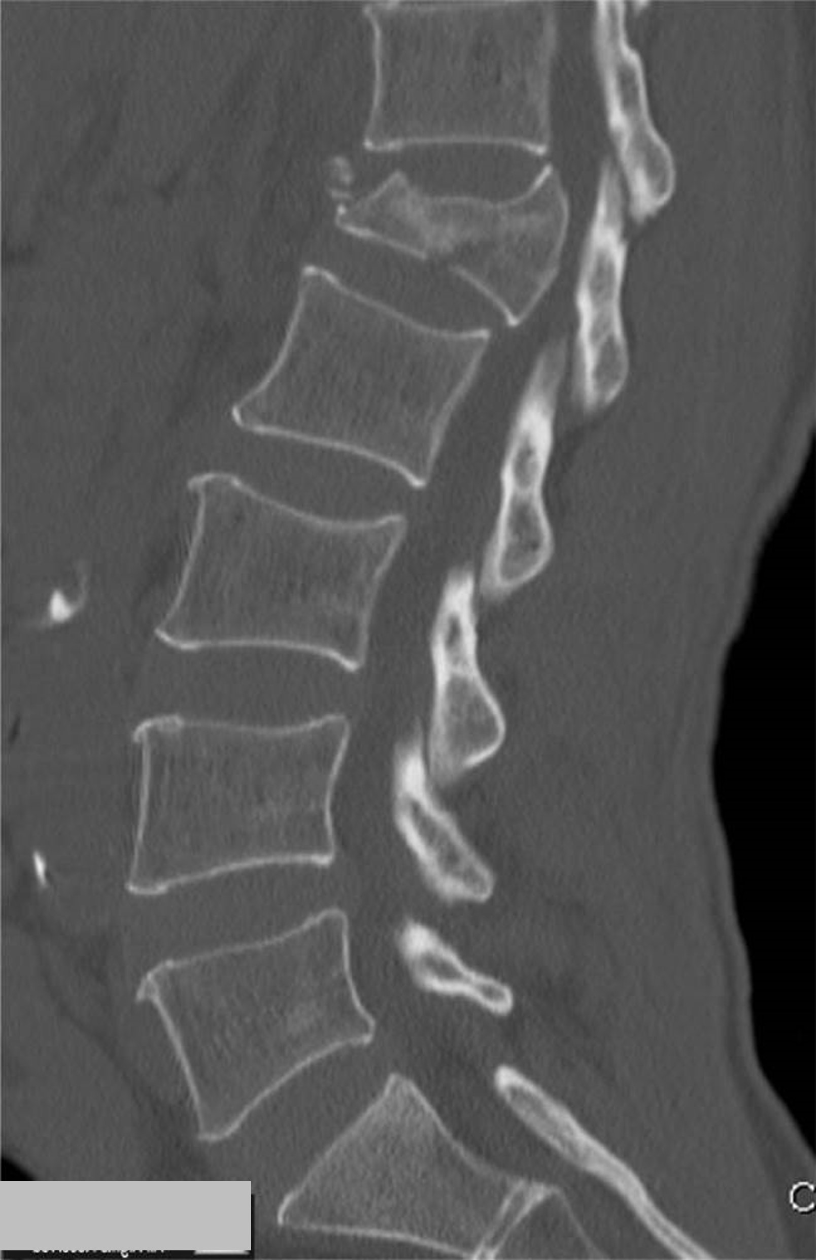 <p>What is the diagnosis?</p>