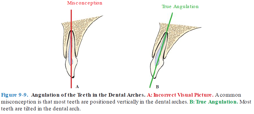<ul><li><p>Misconception — Tooth is vertical </p><ul><li><p>Teeth is NOT flat </p></li><li><p>This misconception causes people to position lower shank incorrectly</p></li></ul></li><li><p><strong>True angulation</strong></p><ul><li><p>Teeth are tilted</p></li></ul></li></ul><p></p>