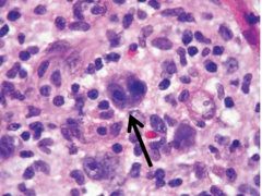 <p>What clinical correlation is this?</p>